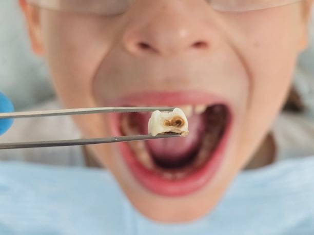 Best Dentist Open Late Near Me  in St Jaco, IL