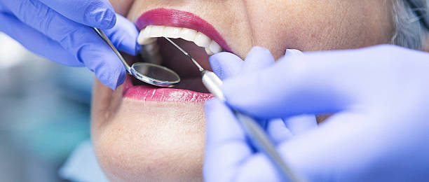 Best Knocked-Out Tooth Emergency  in St Jaco, IL