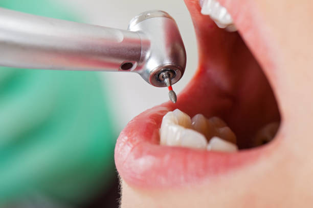 Best Tooth Infection Emergency Dentist  in St Jaco, IL